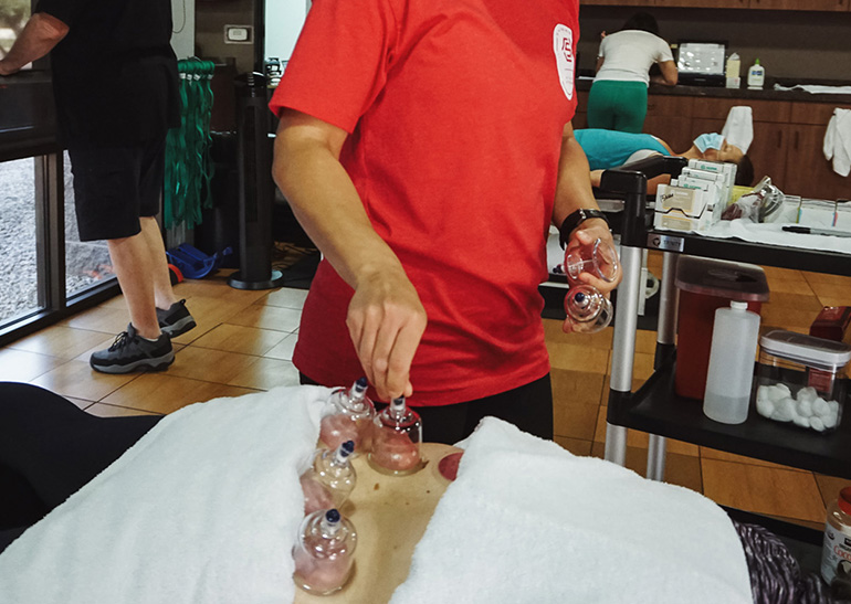 Therapist administering cupping therapy at Synergy Physical Therapy in Scottsdale, AZ