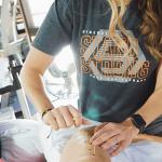 Dry Needling vs Acupuncture: Which Is Right for Muscle Pain?